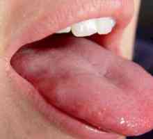 Prečo špička jazyka škodí, aké liečenie je potrebné