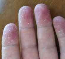 Prečo koža na prstoch