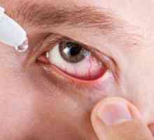 Sčervenanie očí a zápal: príčiny a symptómy, liečba