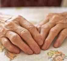 Polyartritída prstov: liečba tradičnými a ľudovými prostriedkami