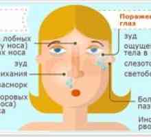 Pollinóza: príčiny, príznaky a liečba polinózy u detí