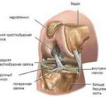Poškodenie menisku kolenného kĺbu: príznaky a liečba