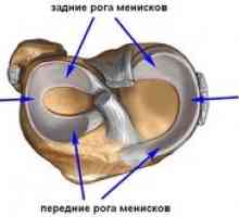 Poškodenie a liečba meniskusu kolenného kĺbu