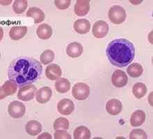 Zvýšené bazofily v krvi dieťaťa: a príčiny a liečba