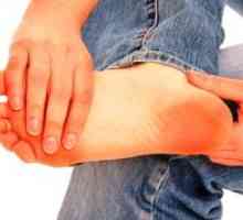 Príčiny bolesti nôh pri chôdzi
