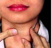 Symptómy ochorenia štítnej žľazy a spôsoby liečby žien