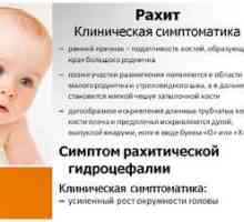 Prevencia rachity u detí: príčiny ochorenia, aktivity