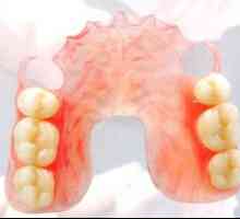 Protetická stomatológia: typy, popis a ceny pre zubné protézy