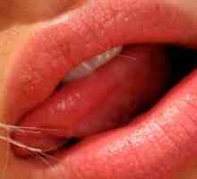 Akné a pupienky v jazyku - čo robiť