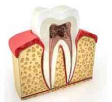 Celulóza zubu, jeho štruktúra, funkcie a metódy liečby