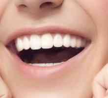 Remineralizácia zubov doma: indikácie