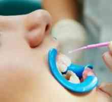 Strieboranie zubov u detí: pre a proti