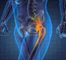 Symptómy ochorenia bedrového kĺbu a jeho liečba