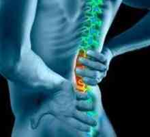 Príznaky a liečba ochorení a ochorení chrbtice