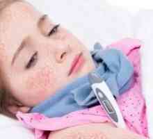 Šarlátová horúčka u detí: príznaky a liečba, foto
