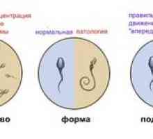 Spermogramma pre mužov: ako urobiť spermogram