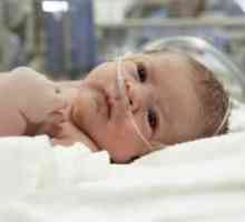 Stridoroznoe dýchanie u novorodencov: príčiny a liečba