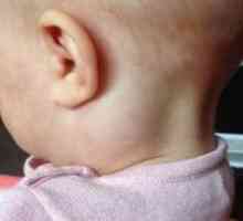 Rozšírené lymfatické uzliny na krku dieťaťa - dôvody pre vzhľad