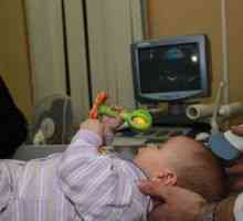 Ultrazvuk mozgu u novorodencov