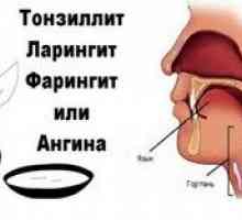Aký je rozdiel medzi faryngitídou a laryngitídou? Známky laryngofaryngitídy
