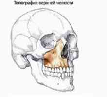 Horná čeľusť: štruktúra hornej čeľuste, patológia, poruchy