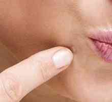 Druhy a metódy liečby fibroidu kože