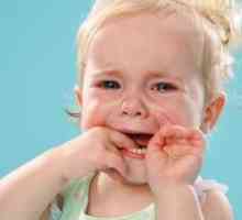 Vírusová stomatitída u detí: príznaky a liečba