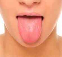 Blistre na jazyku sú bližšie k hrdlu: pľuzgiere na koreň a vezikuly