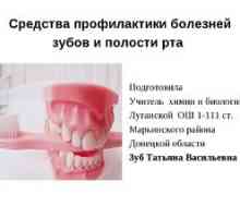 Choroby ústnej dutiny: hlavné choroby a prevencia