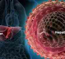 Je žltačka vírusom akého druhu hepatitídy?