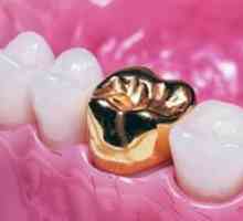 Zlaté zuby - kvalitná stomatológia alebo mauvetón?