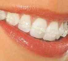 Zubový systém: vlastnosti systémov a ich inštalácia