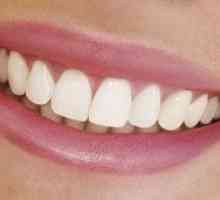 Zubné miesta: metódy na odstránenie tmavých škvŕn na zuboch