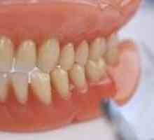 Zubné protézy novej generácie bez patra