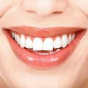 Biele škvrny na zuboch: symptómy, príčiny vzhľadu u dospelých a detí