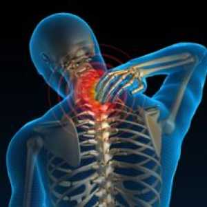 Cervikalgia a príznaky ochorenia krčnej chrbtice