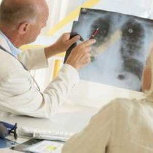 Čo je bazálna pneumokróza, trvanie liečby