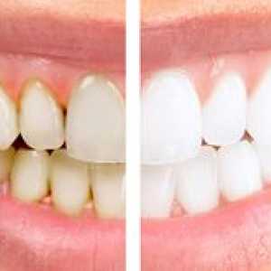 Čo je hygienické čistenie zubov?