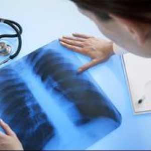 Aké je zlepšenie pľúcneho vzoru na röntgen?