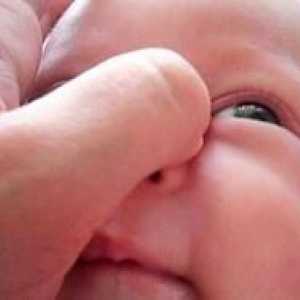 Dakryocystitída u novorodencov, symptómy a liečba