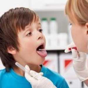 Faryngitída u detí: príznaky a liečba