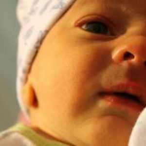 Hemolytická žltačka u novorodencov