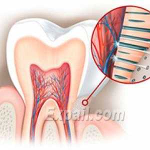 Hyperestézia zubnej skloviny: príčiny, symptómy a liečba