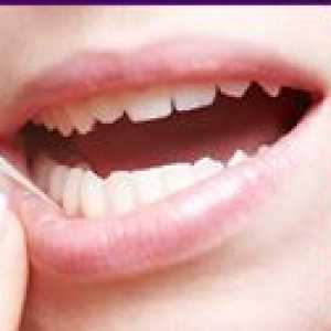Účinok plazmoliftingu v zubnom lekárstve