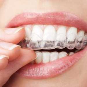 Ako správne vyrovnať a narovnať svoje zuby doma