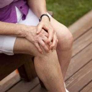 Ako liečiť artritídu kolena: lieky na liečbu
