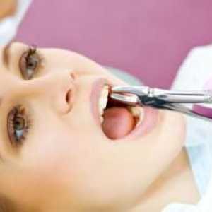 Ako zastaviť krv po extrakcii zubov