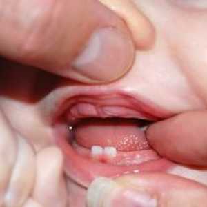 Ako deti rastú zuby: poriadok a konzistencia