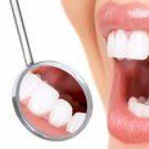 Ako odstrániť zubný kameň v zubnom lekárstve a doma?