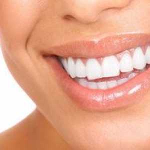 Ako si vybrať zubný mostík: typy mostov na zuboch, ich ceny